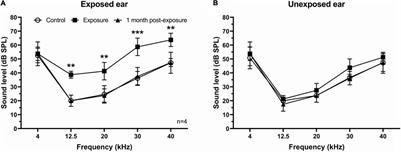 Effect of Unilateral Acoustic Trauma on Neuronal Firing Activity in the Inferior Colliculus of Mice